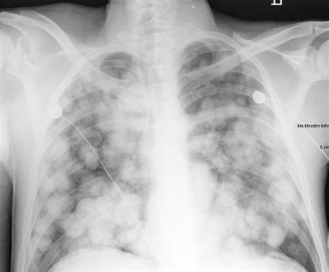 Pin on Radiographic Images