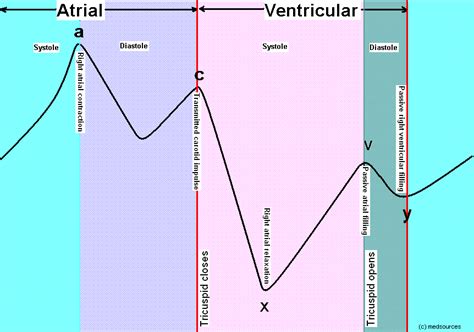 Jugular Venous Pulse, Pressure and abnormalities | All about Medical ...