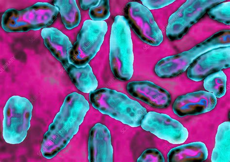 Pseudomonas aeruginosa - Stock Image - C012/9506 - Science Photo Library