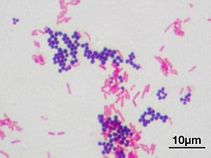 Gram-positive bacteria - Wikipedia