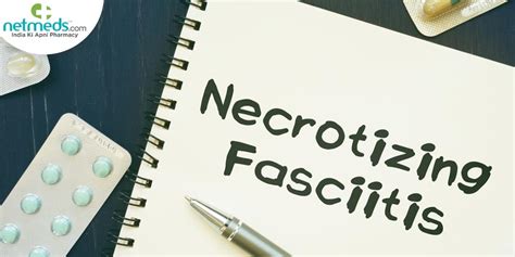 Necrotizing Fasciitis: Symptoms, Causes And Treatment