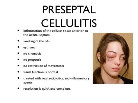 Preseptal And Orbital Cellulitis