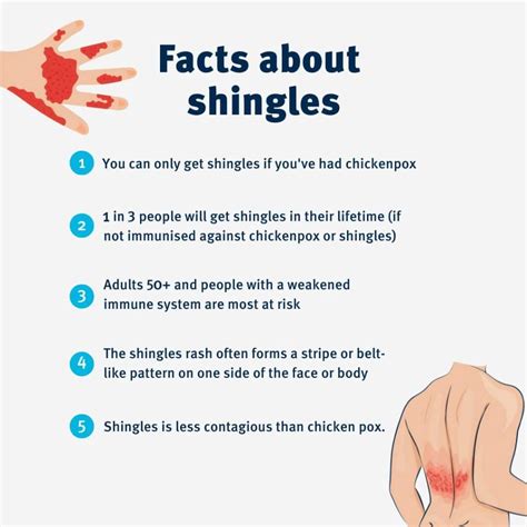 Shingles Catch-up Vaccines are available for adults aged 71 to 79 years ...