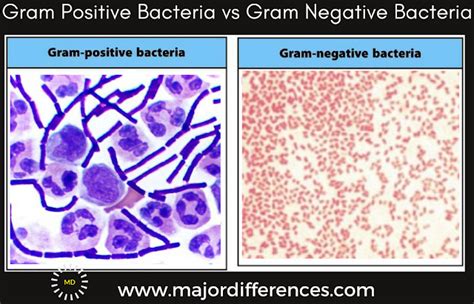 Example of Gram Positive Bacteria