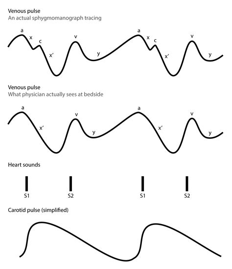 Examination of Neck Veins - Venous Waveform - Timotej Vataha