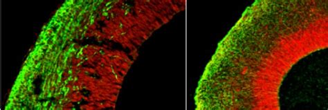 Stem cells used to create mini-brains in the lab | Ars Technica