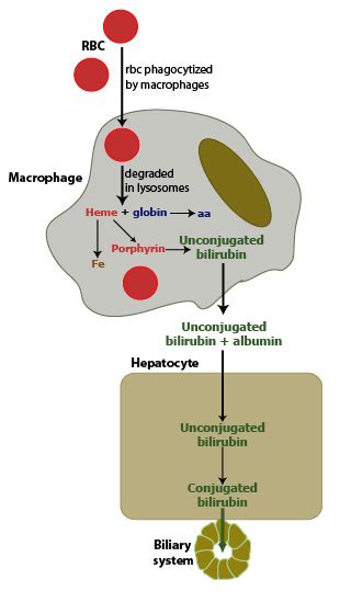 Production of bilirubin with hemolysis | eClinpath