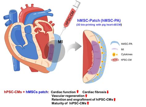 Novel dual stem cell therapy improving cardiac regeneration | Science Codex