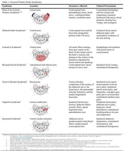 Medial Pontine Syndrome