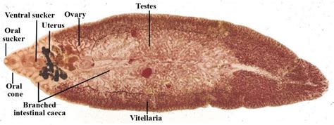 Fasciola Hepatica