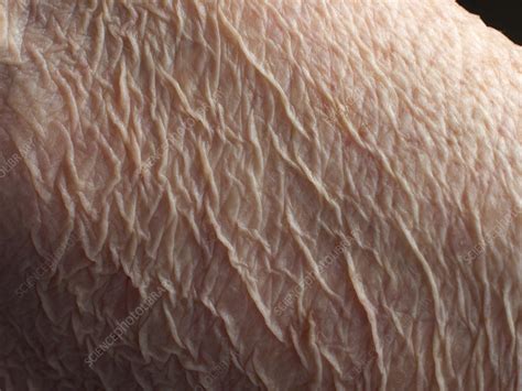 Wrinkly Skin of an Old Woman - Stock Image - C013/0642 - Science Photo ...