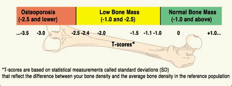 Bone density chart by age - dashmokasin