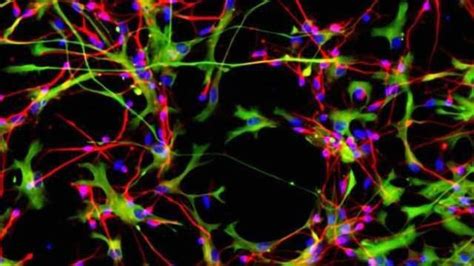 Researchers create 'mini-brains' in lab to study neurological diseases ...