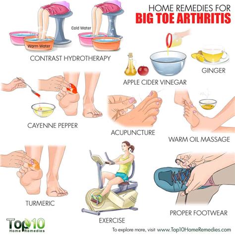 Home Remedies for Big Toe Arthritis | Top 10 Home Remedies