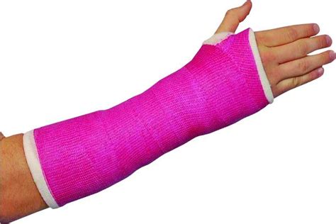 Waterproof Casts - FIT AS A PHYSIO | MOSMAN