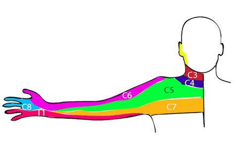 Cervical Nerve Root Dermatomes