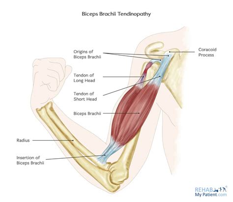 Bicep Muscle Tendon Anatomy | Porn Sex Picture