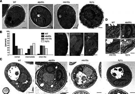 Cristae morphology is defective in mio10 Δ . (A) Electron microscopy of ...