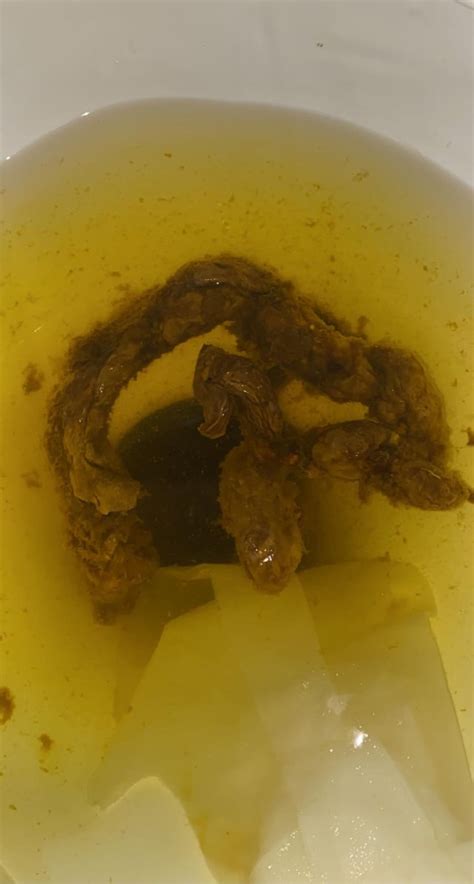 Is this blood in my stool? And why have my shits been looking like this ...