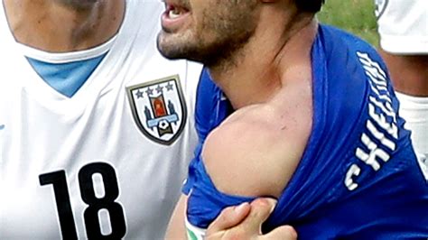 FIFA charges Luis Suarez for biting incident