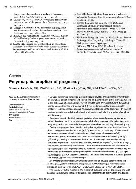 (PDF) Polymorphic eruption of pregnancy | Marzia Caproni - Academia.edu