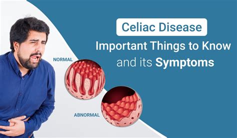 Celiac Disease Important Things to Know and Its Symptoms