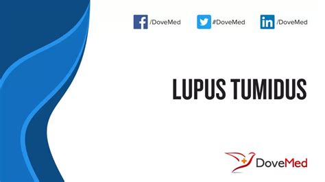 Lupus Tumidus - DoveMed