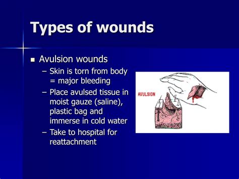 PPT - Wound Care PowerPoint Presentation, free download - ID:134758