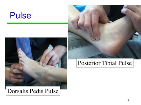 Posterior tibial and dorsalis pedis pulses