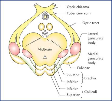 Diencephalon and third ventricle | Neupsy Key