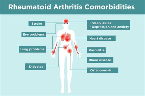 Rheumatoid Arthritis Complications: What RA Patients Need to Know