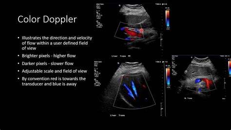 What is sonography test