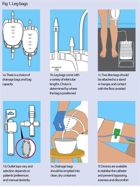 Urinary catheters 3: catheter drainage and support systems | Nursing ...