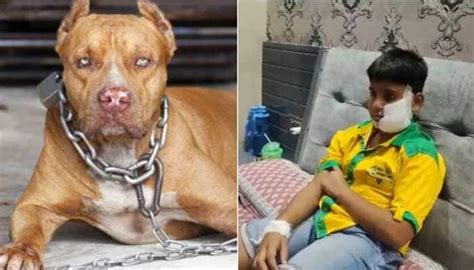 Ghaziabad: Pitbull dog bites 10-year-old boy's face and ears; victim ...