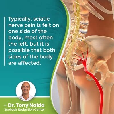 What Will The Hospital Do For Sciatica Pain? Anything?