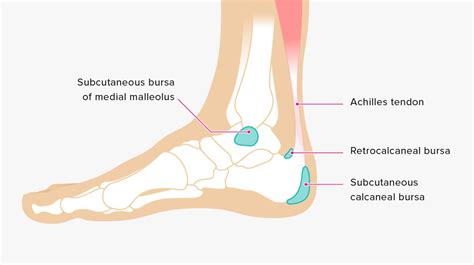 Bursitis: Ankle Bursa, Care, and Prevention