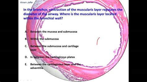 What are the histological differences between trachea and bronchus ...