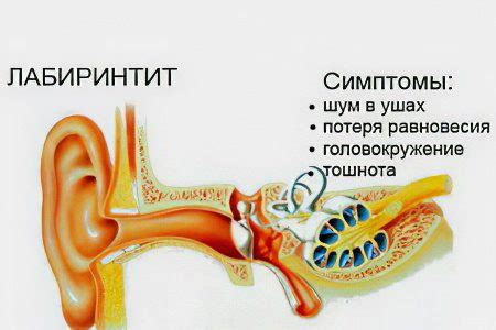 Labyrinthitis: symptoms and treatment – Healthy Food Near Me