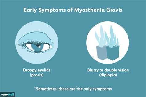 Tensilon Test for Myasthenia Gravis: What to Know