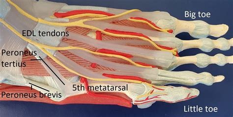 5th Metatarsal Fracture | Dr Ben Beamond | Adelaide