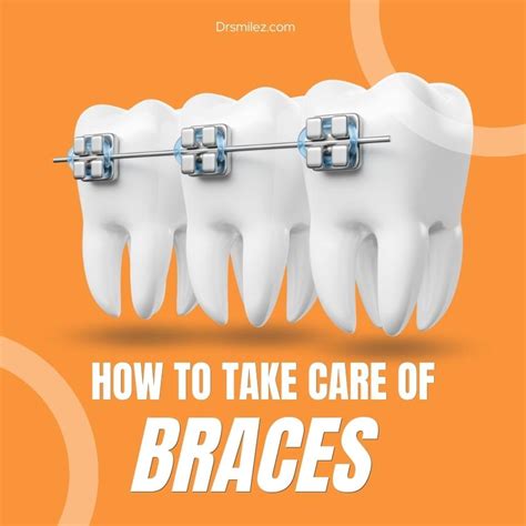 How to Take Care of Your Braces: 5 Useful Tips