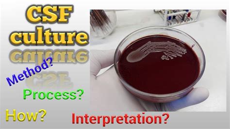 CSF Culture test procedure Microbiology - YouTube