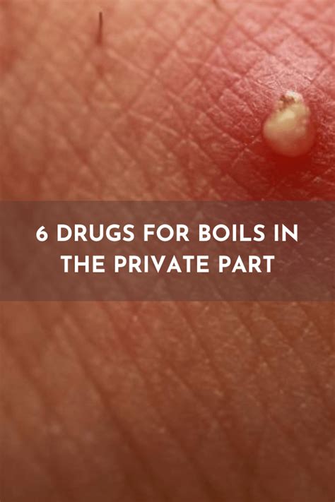 5 drugs for boils in the private part: choose the right treatment