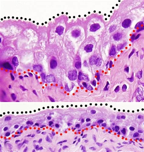 Transitional Epithelium Tissue