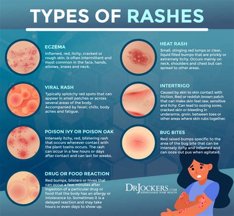 Can antibiotics cause a rash on the face