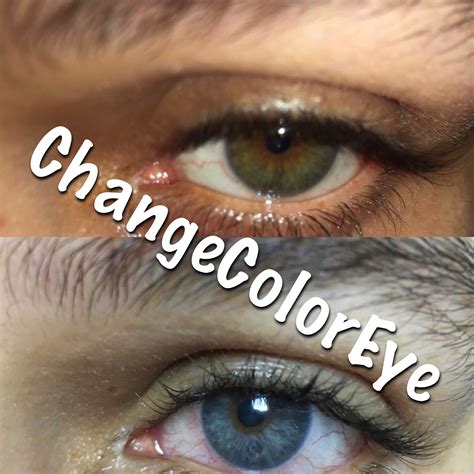 Pin on Colored Eyes