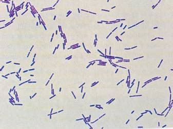 How do you observe Lactobacillus bacterium?