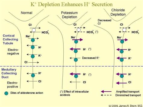 hypokalemia metabolic alkalosis | Metabolic alkalosis, Physiology ...