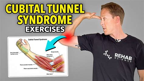 3 Exercises for Cubital Tunnel Syndrome (Ulnar Nerve Rehab) - YouTube