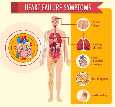 Congestive Heart Failure - East Cardiovascular Specialists